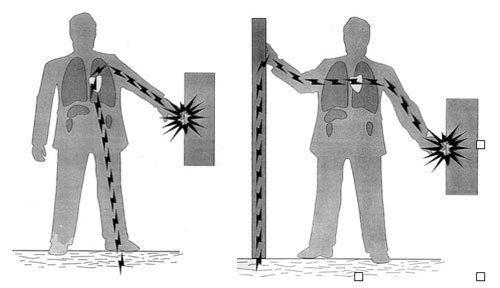 Illustration of electrical paths through the body.